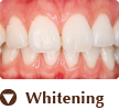 Whitening